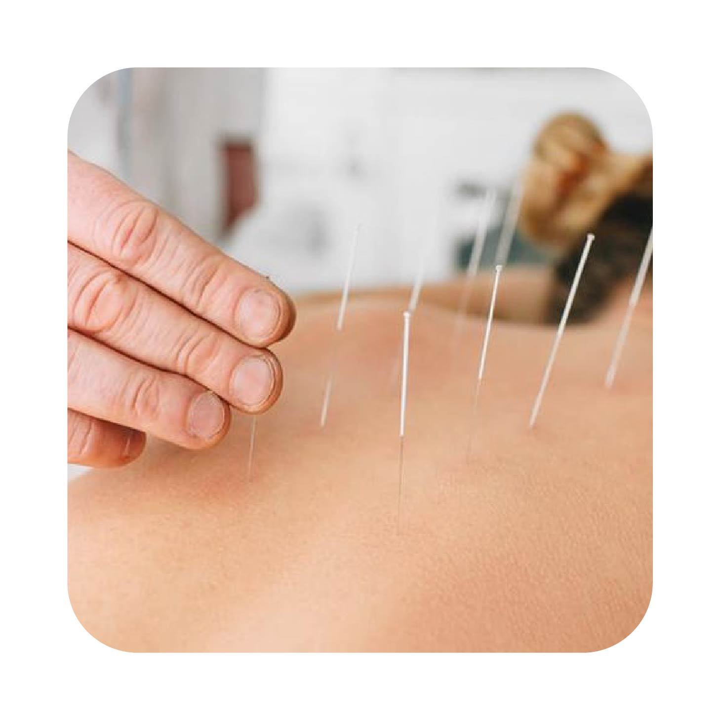 USA Acupuncturist Email List Database